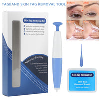 Thumbnail for Skin Tag Removal Kit